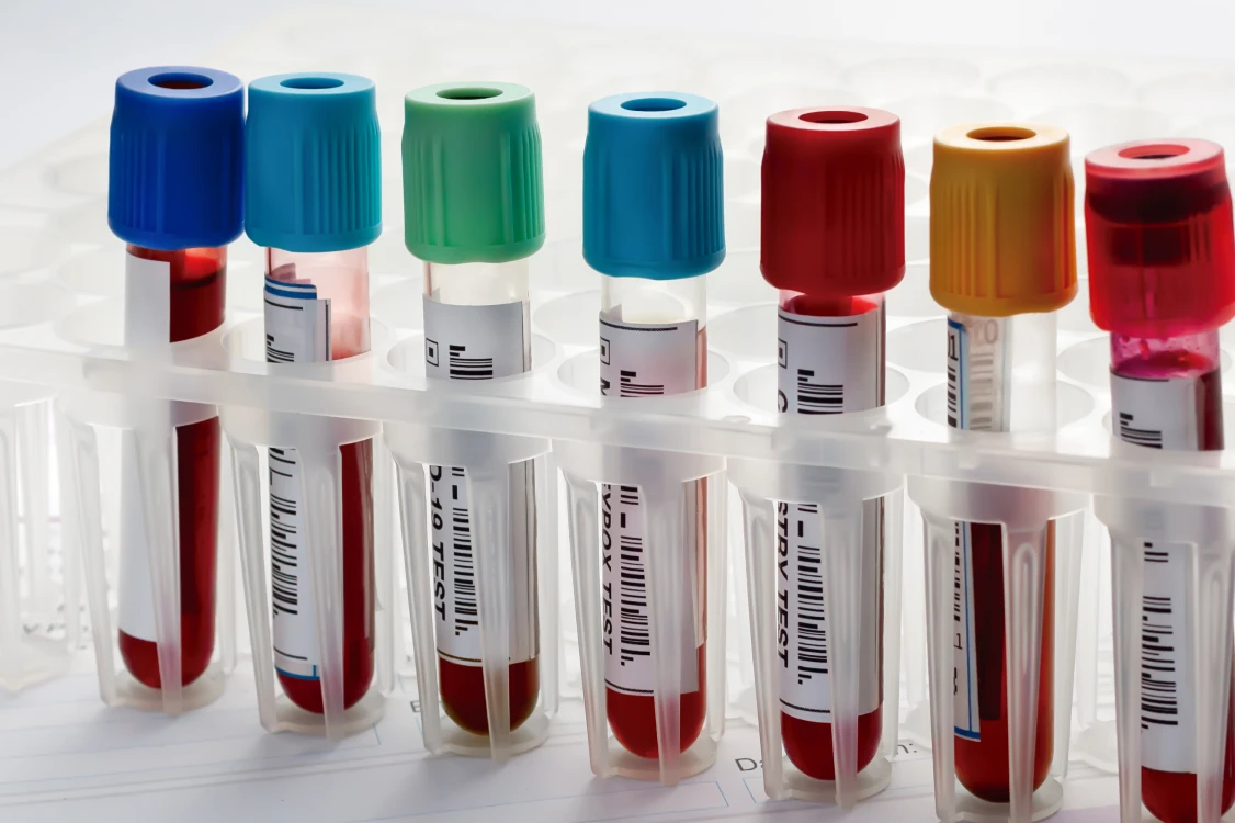 Blood samples in test tubes